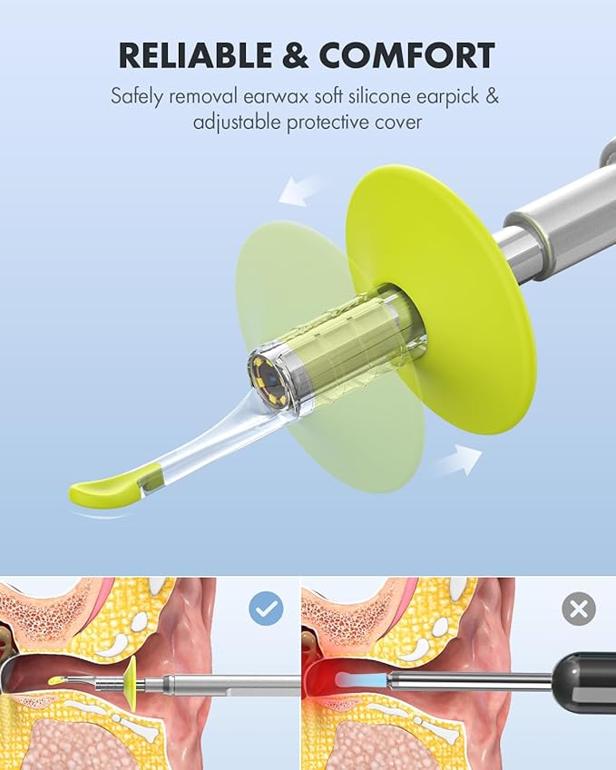 Anykit Digital Otoscope with Gyroscope, 4.5 Inches Screen, 3.9mm Ear Scope - Image 4