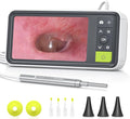 Anykit Digital Otoscope with Gyroscope, 4.5 Inches Screen, 3.9mm Ear Scope by ANYKIT
